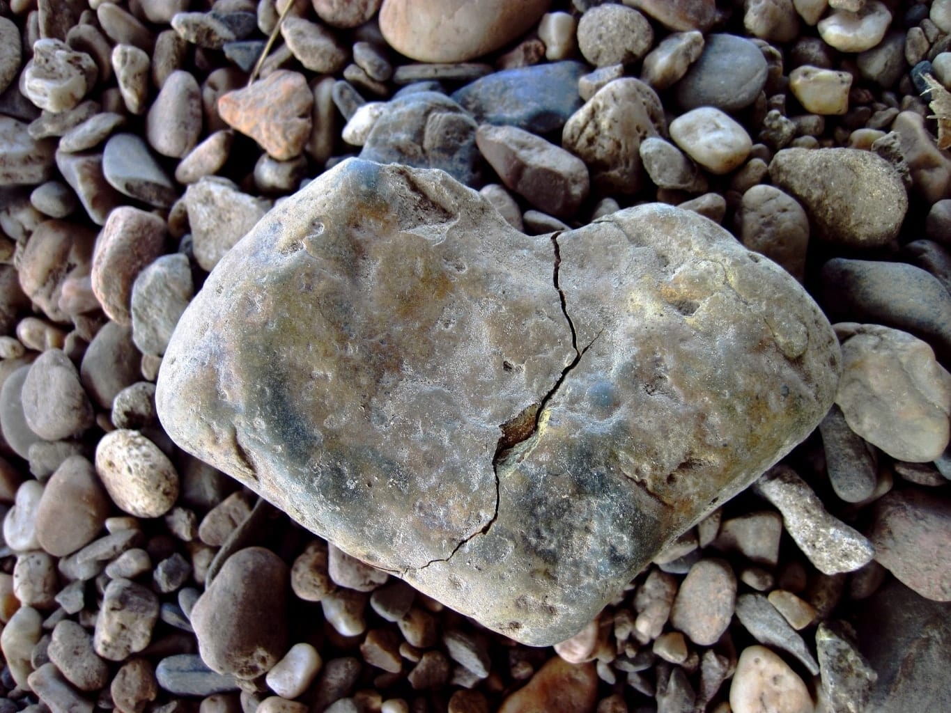 אבנים בכליות טיפול נכון