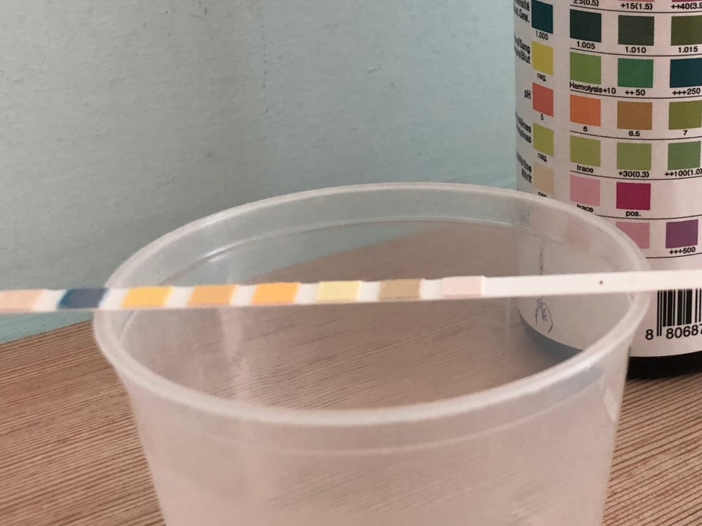 דלקת בשתן עם דם