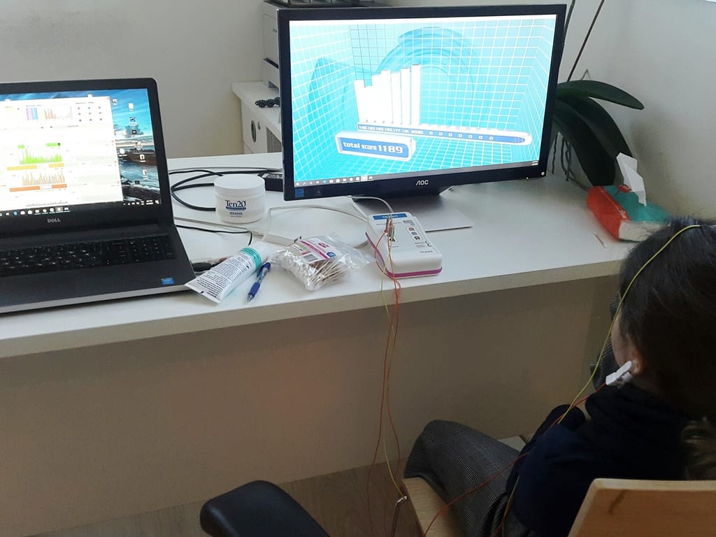 על ADHD ונוירופידבק